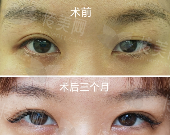 北京整形美容医院排名前十的名单预览!北京丽都/北京美莱/北京艺星/北京华美等医院都不错~
