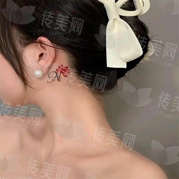 北京洗纹身好的地方有哪些?看10家医院名单