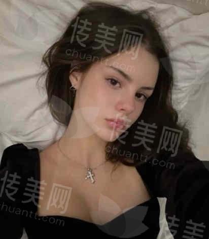 解密南京华美去眼袋:案例+医生资质,帮你选对医院和医生!