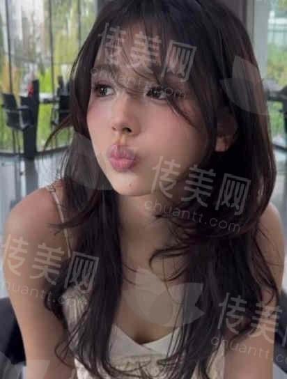徐荣阳医生隆鼻怎么样?案例分享+医院地址+口碑评价