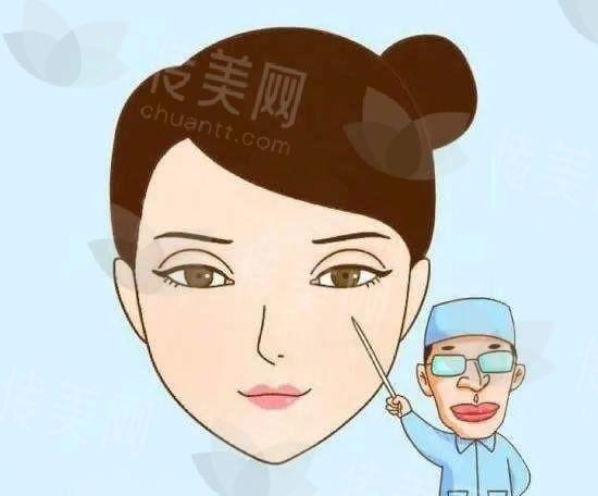 深圳艺星整形眼部整形手术案例分享-平扇型双眼皮效果自然