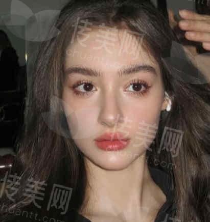 沈阳百嘉丽:隆鼻技术哪家强?孙磊医生专业点评,附真实案例对比!