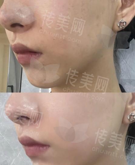 寻找范荣杰医生?他目前在哪家医院?医院详情及隆鼻双眼皮案例分享