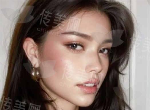 广州海峡隆鼻效果揭秘!真实案例让你大开眼界
