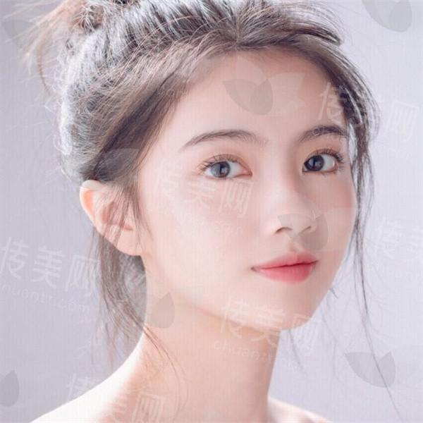 陈小剑医生做双眼皮怎么样?速看专家资料与参考价格分享
