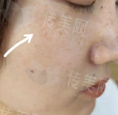 济南激光祛斑好的医院是哪家?济南海峡、济南诺德、济南艺星等5家实力医院