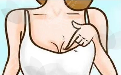 成都胸部整形好的医院有哪些?当地口碑医院盘点|收费表
