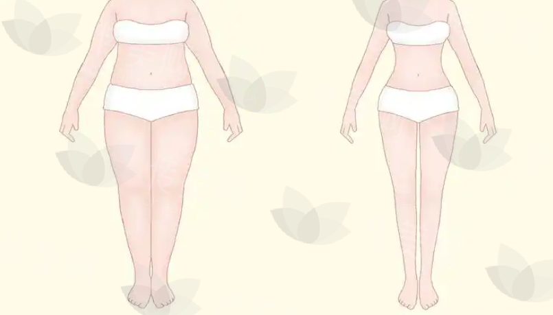 腰腹吸脂比较好的医生有哪些?朱力、顾云鹏、王明利等实力医生上榜