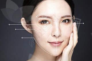 深圳哪家整形机构擅长双眼皮修复手术?深圳军科/深圳阳光都不错,刘月更/李鹏医生眼修复价格6800元起
