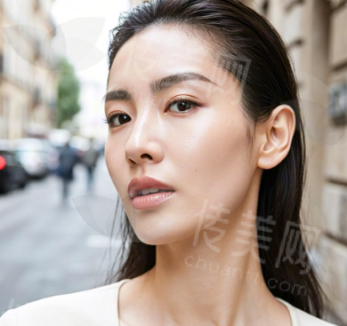 呼和浩特华美整形白虎隆鼻怎么样?超多白虎案例及价格请查收