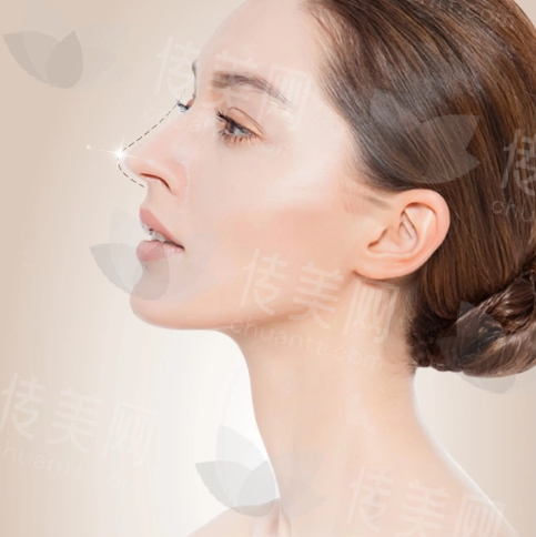 北京李劲良做鼻子口碑好吗?分享医生信息-隆鼻案例分享