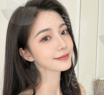 赣州隆鼻鼻综合哪里做的好?赣州叶子整形谢瑶隆鼻鼻综合技术实力雄厚价格低,隆鼻5000元起,预约多