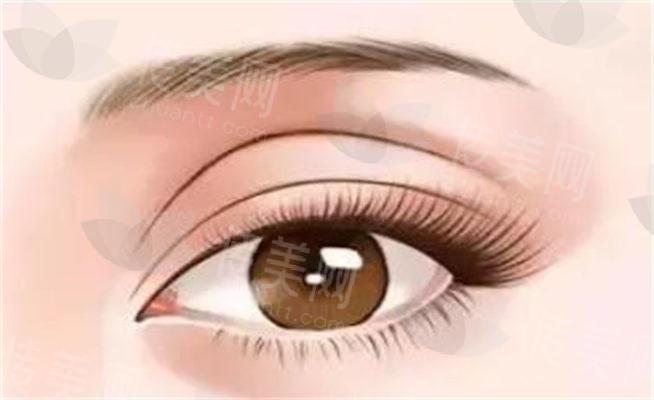 宁波双眼皮修复哪家医院好?宁波艺星整形眼修复术后效果自然、符合面部比例