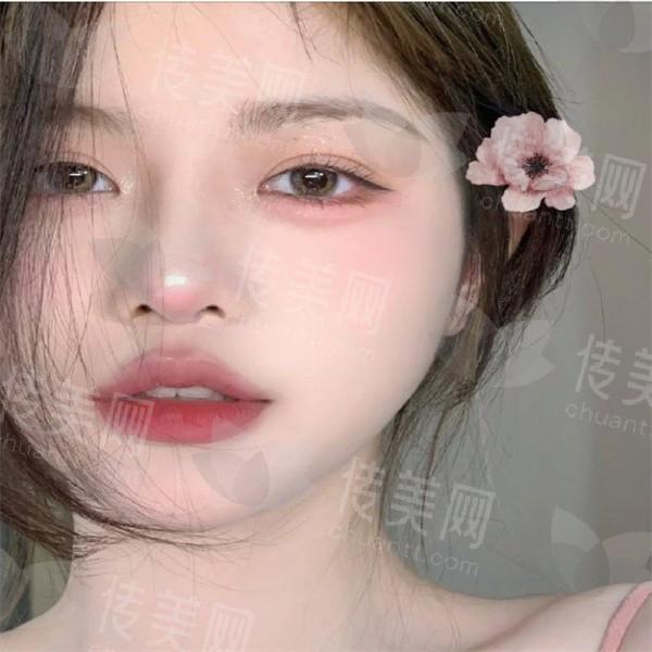 武汉唇部整形术哪家医院好?医院做唇部项目技术好的医生推荐!