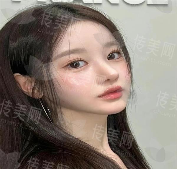 嘉兴做鼻子的专家排名有哪些?精选top五医生评价