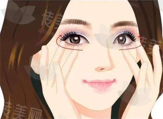 潍坊天宏整形美容医院口碑如何?张明欣医生擅长眼部整形-祛眼袋案例分享