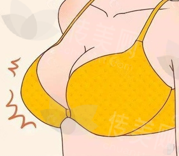 郑州脂肪隆胸的医生哪那个好?郑州华领徐刚强、郑州芳艺乔长顺邓医生都不错~