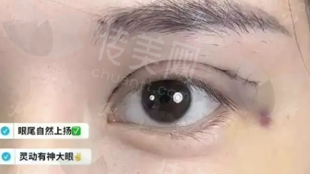 许炎龙擅长什么?附上专家介绍-经典案例曝光啦
