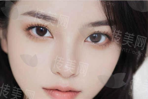 沈阳隆胸哪家医院好?沈阳美莱、沈阳名流等玻尿酸隆胸价格约五万元左右