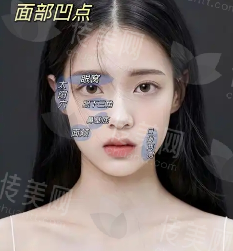 河南脂肪填充哪个医生做得好?郭晓光、张俊峰、吴勇等实力不俗!