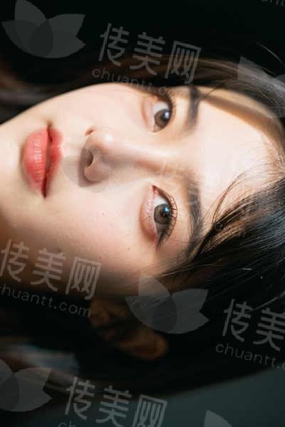 武汉杨乐医生做鼻子到底好不好?技术硬核到同行自闭