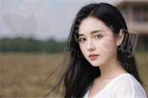 南京艺星朱姗姗:双眼皮整形技术特色详细介绍 口碑极好