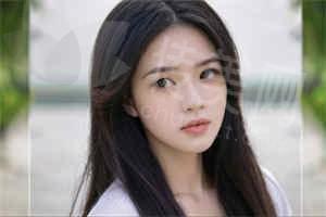 重庆双眼皮手术哪家强?TOP5 医院实测:医生审美在线,自然到妈生款